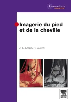 Imagerie du pied et de la cheville