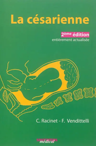 La césarienne : une approche fondée sur les faits