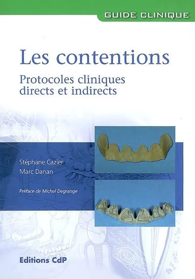 Les contentions : protocoles cliniques directs et indirects