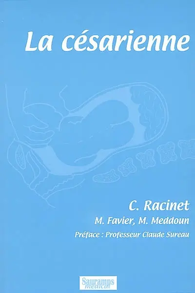 La césarienne