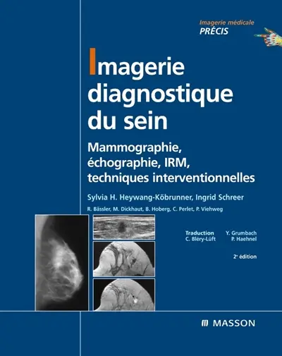Imagerie diagnostique du sein : mammographie, échographie, IRM, techniques interventionnelles