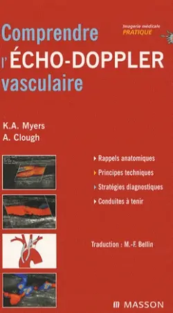 Comprendre l'écho-Doppler vasculaire