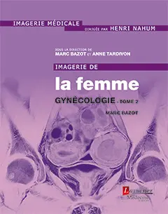 Imagerie de la femme. Vol. 3. Gynécologie. Vol. 2