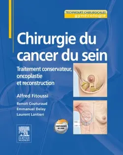 Chirurgie du cancer du sein : traitement conservateur, oncoplastie et reconstruction