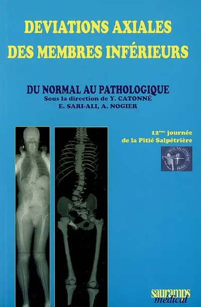 Déviation axiale des membres inférieurs : du normal au pathologique