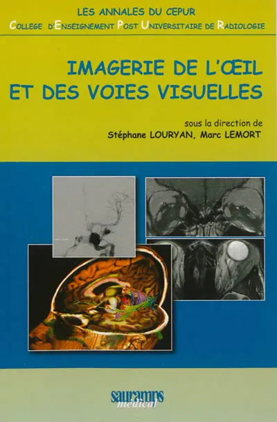 Imagerie de l'oeil et des voies visuelles