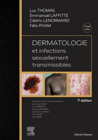 Dermatologie et infections sexuellement transmissibles