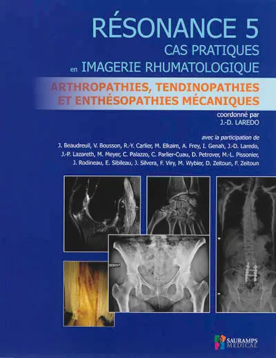 Résonance : cas pratiques en imagerie rhumatologique. Vol. 5. Arthropathies, tendinopathies et enthésopathies mécaniques