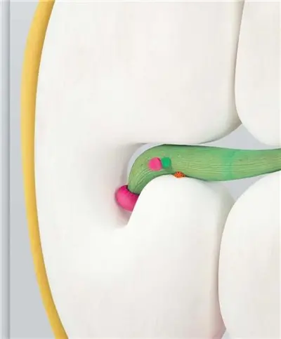 Matthew Ronay (Greg Miller 2016)