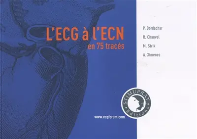 L'ECG à l'ECN en 75 tracés