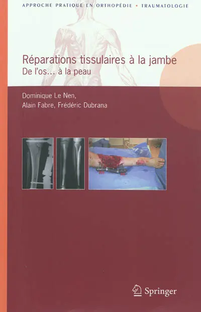 Réparations tissulaires à la jambe : de l'os... à la peau