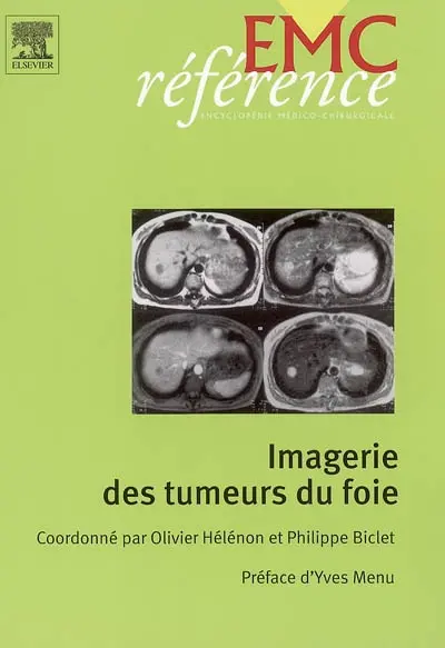 Imagerie des tumeurs du foie