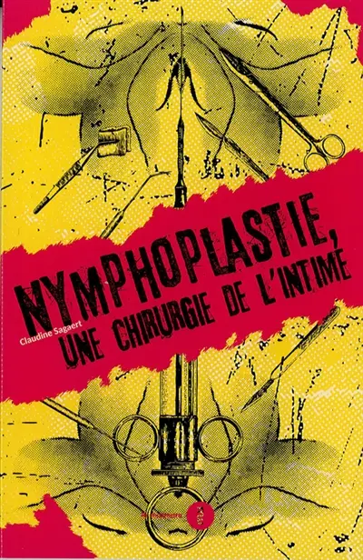 Nymphoplastie, une chirurgie de l'intime