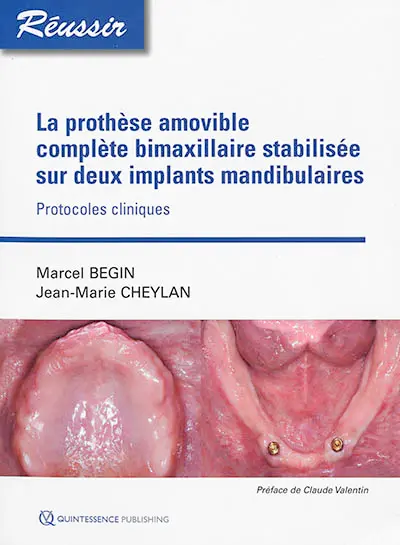 La prothèse amovible complète bimaxilliaire stabilisée sur deux implants mandibulaires : protocoles cliniques