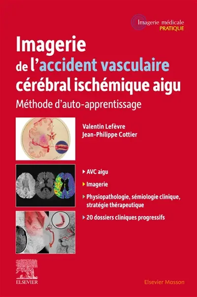 Imagerie de l'accident vasculaire cérébral ischémique aigu : méthode d'auto-apprentissage
