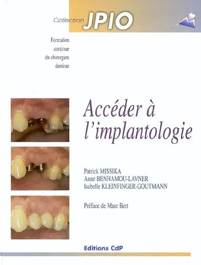 Accéder à l'implantologie