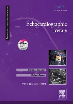 Echocardiographie foetale