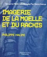 L'Imagerie de la moelle et du rachis