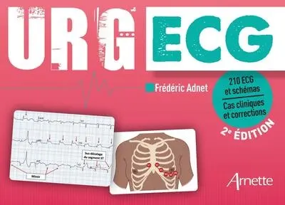 Urg' ECG : 210 ECG et schémas : cas cliniques et corrections