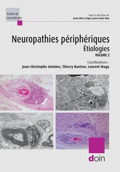 Neuropathies périphériques. Vol. 2. Etiologies