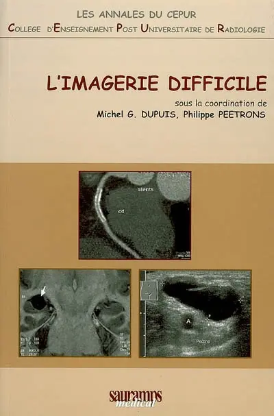 L'imagerie difficile ou Aux frontières du possible
