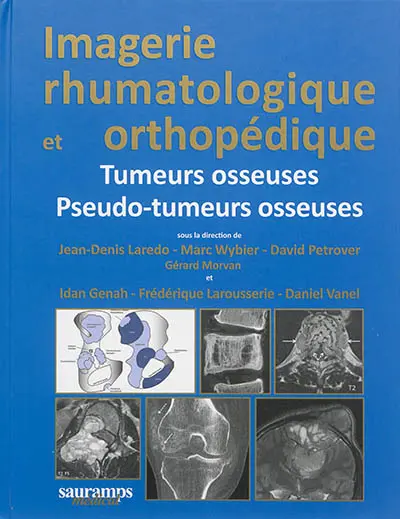 Imagerie rhumatologique et orthopédique. Tumeurs osseuses, pseudo-tumeures osseuses