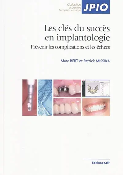 Les clés du succès en implantologie : prévenir les complications et les échecs