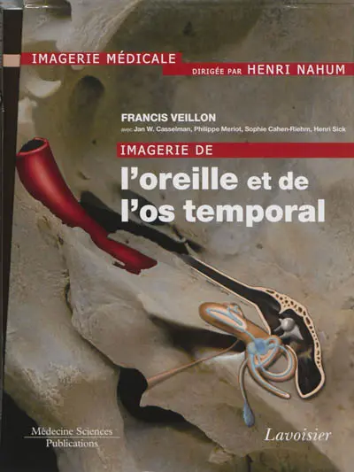 Imagerie de l'oreille et de l'os temporal