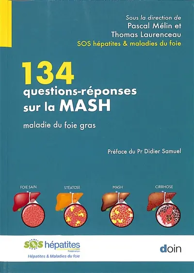 134 questions-réponses sur la MASH : maladie du foie gras