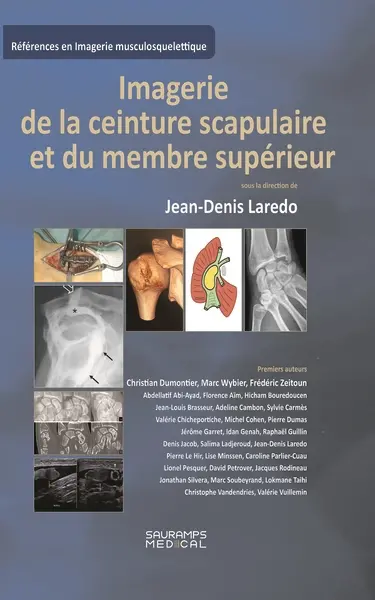 Imagerie de la ceinture scapulaire et du membre supérieur
