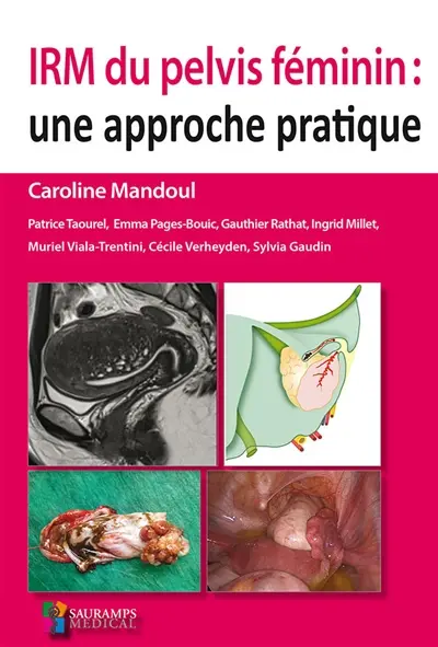 IRM du pelvis féminin : une approche pratique