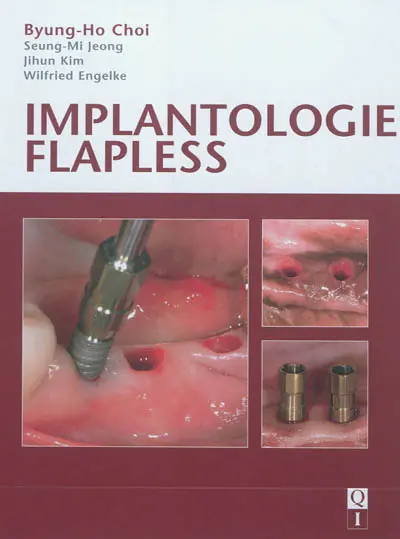 Implantologie flapless