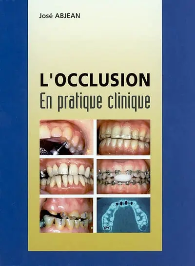 L'occlusion : en pratique clinique