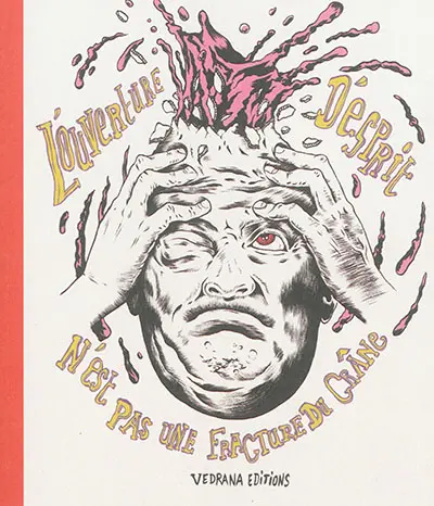 L'ouverture d'esprit n'est pas une fracture du crâne