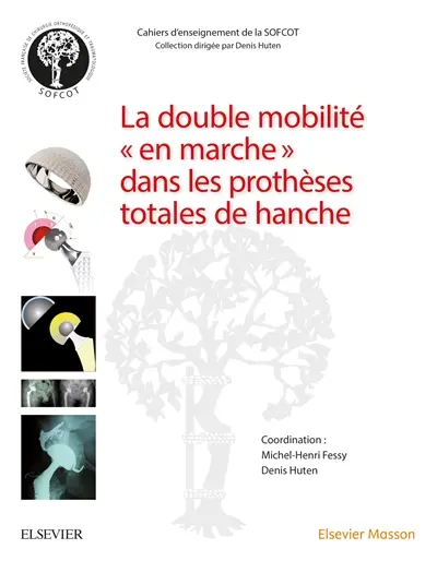 La double mobilité en marche dans les prothèses totales de hanche