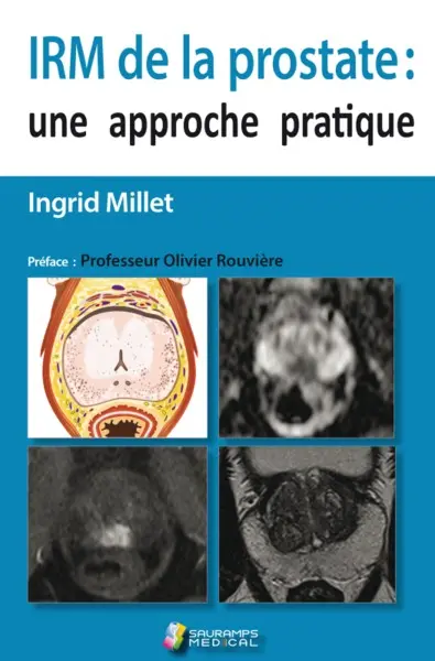 IRM de la prostate : une approche pratique