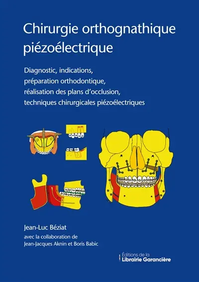 Chirurgie orthognathique piézoélectrique : Diagnostic, indications, préparation orthodontique, réalisation des plans d'occlusion, techniques chirurgicales piézoélectriques