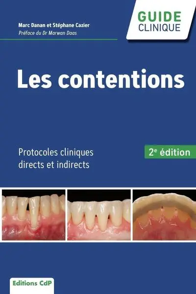 Les contentions : protocoles cliniques directs et indirects
