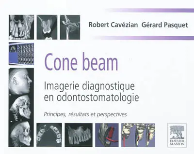 Cone beam : imagerie diagnostique en odontostomatologie : principes, résultats et perspectives