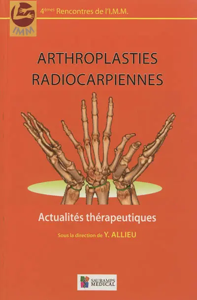 Arthroplasties radiocarpiennes : actualités thérapeutiques